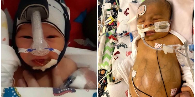 Mother Blames “Vaccinated Blood” for the Death of Her One-Month-Old Baby Who Died from Blood Clot Following Blood Transfusion