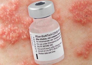 Shingles