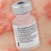 Shingles