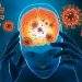 Covid Vaccine Encephalitis