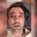 FOX News Meteorologist Violently Beaten on New York Subway