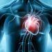 Myocarditis