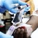Transfusion