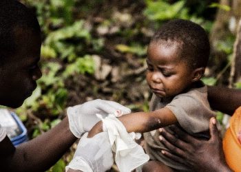 Monkeypox