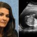 Melinda Gates is Now One of the Biggest Promoters of Abortion in the World