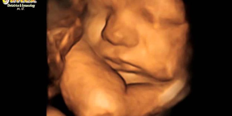 Abortion Increases 90% in New York as Abortion Pills Make Killing Babies Cheap and Easy
