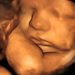 Abortion Increases 90% in New York as Abortion Pills Make Killing Babies Cheap and Easy