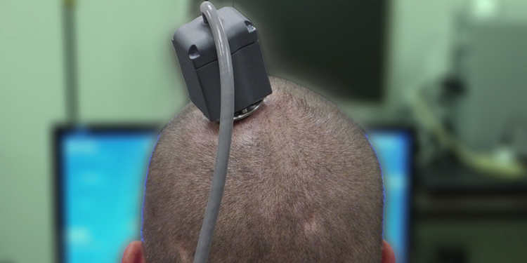 Dystopia: World's first 'biological computer' uses human brain cells that are 'raised in a simulation'