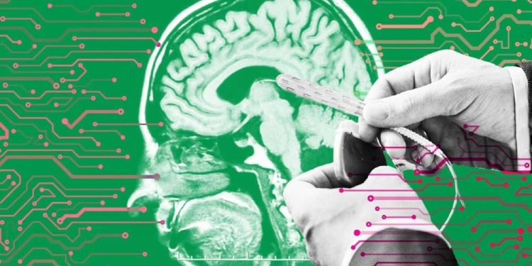 Brain Hack
